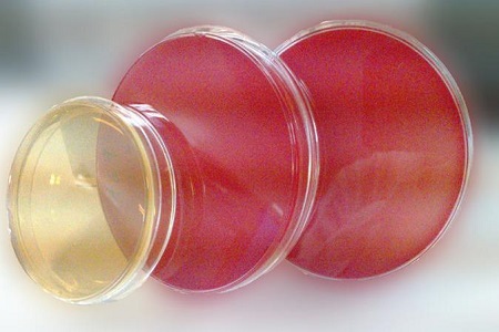 Salmonella Shigella agaras (SS): pagrindinė terpė patogeno išskyrimui