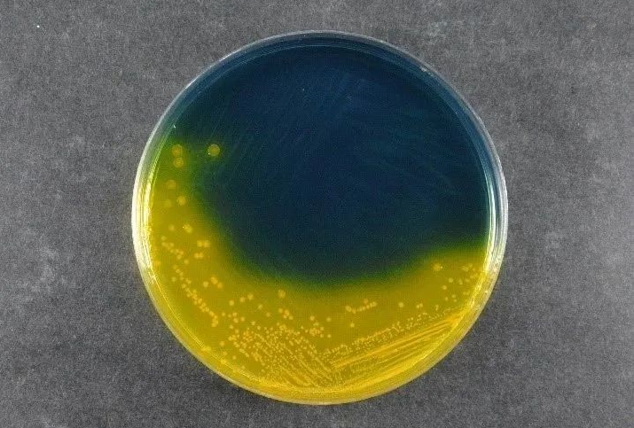 Maisto saugos užtikrinimas: „Babio“ Salmonella Shigella agaras (SS) palaiko pasaulinius patogeno aptikimo standartus