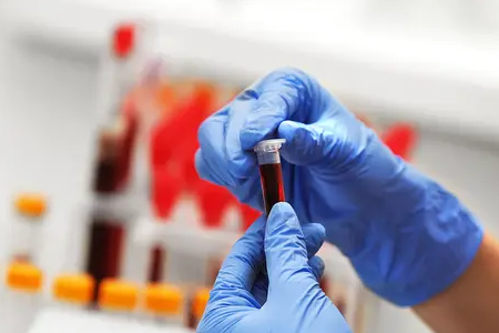 BABIO pradeda greitąjį fluorescencinį galvijų nėštumo testą